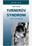 Turnerův syndrom Turnerův syndrom
