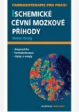 Ischemické cévní mozkové příhody Ischemické cévní mozkové příhody