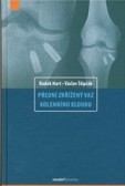 Přední zkřížený vaz kolenního kloubu Přední zkřížený vaz kolenního kloubu