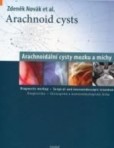 Arachnoidální cysty mozku a míchy Arachnoidální cysty mozku a míchy
