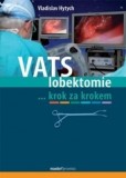 VATS lobektomie VATS lobektomie
