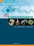 3D Echokardiografie 3D Echokardiografie