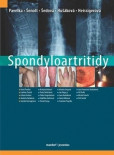 Spondyloartritidy Spondyloartritidy