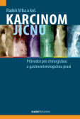 Karcinom jícnu Karcinom jícnu