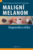 Maligní melanom Maligní melanom