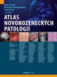 Atlas novorozeneckých patologií Atlas novorozeneckých patologií