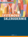 Systémová sklerodermie Systémová sklerodermie