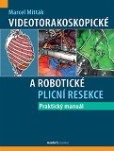 Videotorakoskopické a robotické plicní resekce Videotorakoskopické a robotické plicní resekce