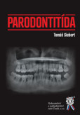 Parodontitída