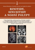 Rinitidy, sinusitidy a nosní polypy Rinitidy, sinusitidy a nosní polypy