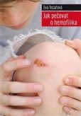 Jak pečovat o hemofilika Jak pečovat o hemofilika