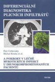 Diferenciální diagnostika plicních infiltrátů Diferenciální diagnostika plicních infiltrátů