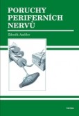 Poruchy periferních nervů Poruchy periferních nervů