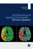 Multidetektorová výpočetní tomografie Multidetektorová výpočetní tomografie