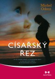 Císařský řez Císařský řez