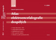 Atlas elektroencefalografie dospělých - 2. díl (2.vydání) Atlas elektroencefalografie dospělých - 2. díl (2.vydání)