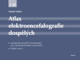 Atlas elektroencefalografie dospělých - 3. díl Atlas elektroencefalografie dospělých - 3. díl