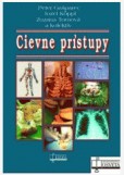 Cievne prístupy Cievne prístupy