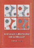 Kvantitatívne hodnotenie štruktúry liatin Kvantitatívne hodnotenie štruktúry liatin