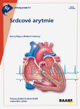 Rýchle fakty: Srdcové arytmie Rýchle fakty: Srdcové arytmie
