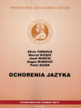 Ochorenia jazyka Ochorenia jazyka