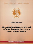 Rádiodiagnostika ochorení pečene, žlčníka, žlčových ciest a pankreasu Rádiodiagnostika ochorení pečene, žlčníka, žlčových ciest a pankreasu
