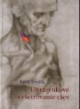 Ultrazvukové vyšetrenie ciev Ultrazvukové vyšetrenie ciev