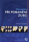 Plán ošetření při poranění zubů