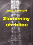 Zlomeniny chrbtice