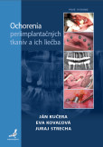Ochorenia periimplantačných tkanív a ich liečba Ochorenia periimplantačných tkanív a ich liečba