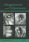 Alkaptonuria and ochronosi Alkaptonuria and ochronosi