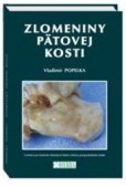 Zlomeniny pätovej kosti