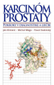 Karcinóm prostaty Karcinóm prostaty