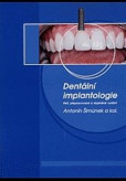 Dentální implantologie, 3. přepracované a doplněné vydání