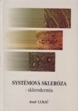 Systémová skleróza - sklerodermia Systémová skleróza - sklerodermia