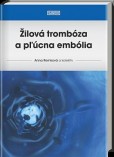 Žilová trombóza a pľúcna embólia Žilová trombóza a pľúcna embólia
