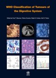 WHO Classification of Tumours of the Digestive Systém