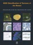Who Classification of Tumours of the Breast Who Classification of Tumours of the Breast