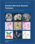 Central Nervous System Tumours