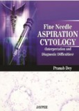 Fine Needle Aspiration Cytology Interpretation and Diagnostic Difficulties Fine Needle Aspiration Cytology Interpretation and Diagnostic Difficulties