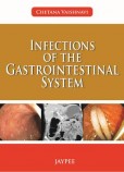 Infections of the Gastrointestinal System Infections of the Gastrointestinal System