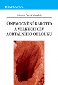 Onemocnění karotid a velkých cév aortálního oblouku Onemocnění karotid a velkých cév aortálního oblouku