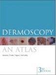 Dermoscopy - An Atlas Dermoscopy - An Atlas