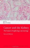 Cancer and the Kidney Cancer and the Kidney