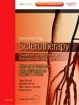Sclerotherapy, 5th Edition Sclerotherapy, 5th Edition