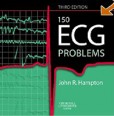 150 ECG Problems 150 ECG Problems