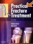 Practical Fracture Treatment Practical Fracture Treatment