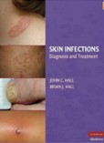 Skin Infections: Diagnosis and Treatment Skin Infections: Diagnosis and Treatment