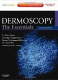 Dermoscopy: The Essentials Dermoscopy: The Essentials