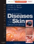Andrews´s Diseases of the Skin Andrews´s Diseases of the Skin
